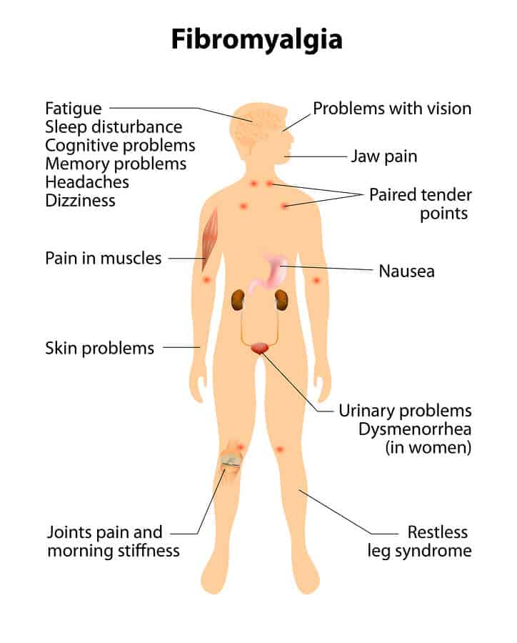Fibromyalgia Natural Treatment Well Wisdom Blog