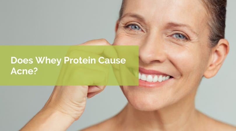 Does Whey Protein Cause Acne?